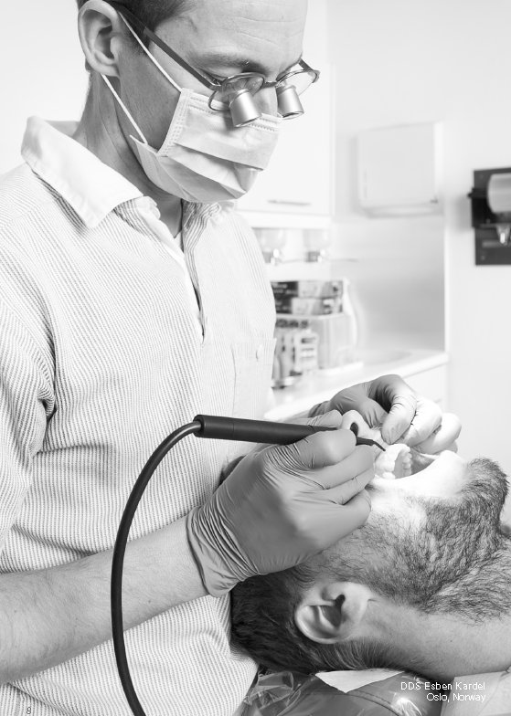 odontosurge in action